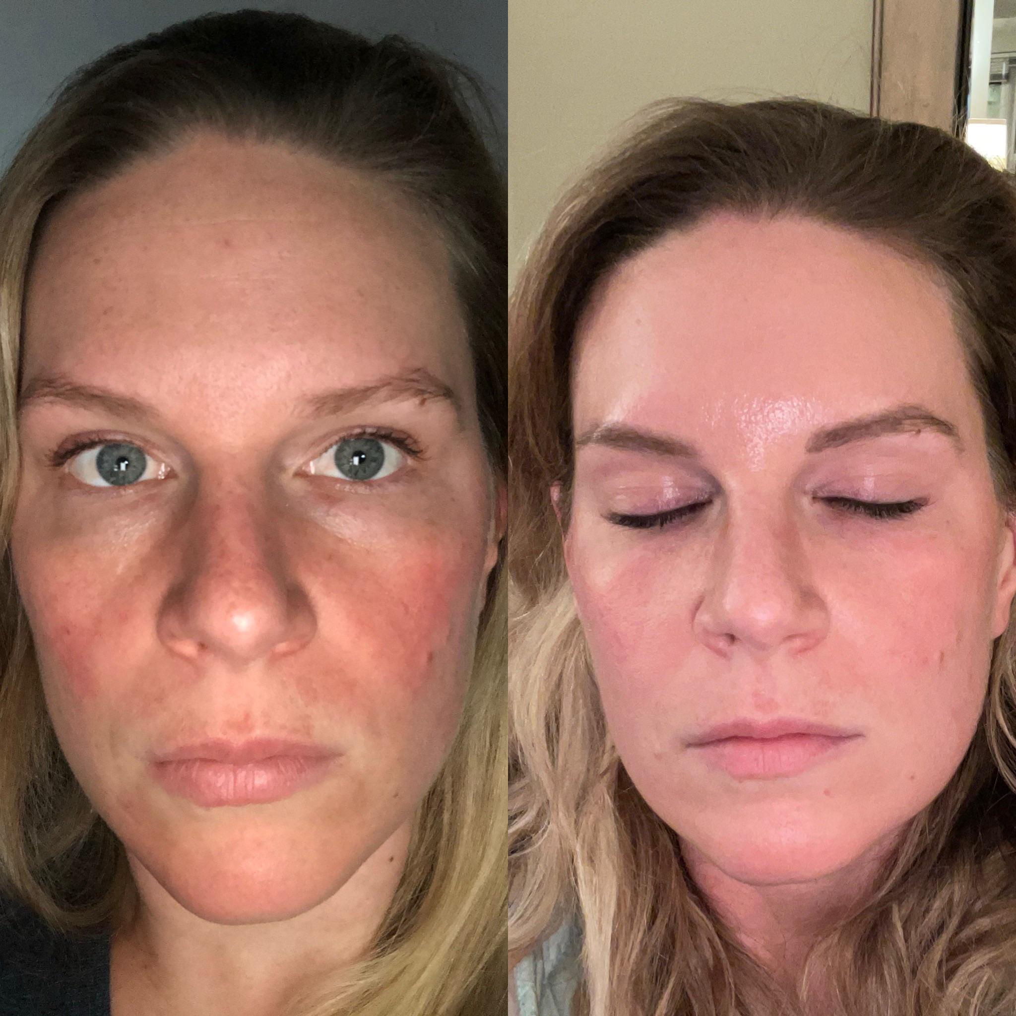 Resultado Anti-Aging